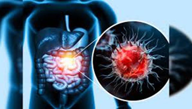 Bowel Cancer : बदललेल्या जीवनशैलीमुळे आतड्याच्या कर्करोगात वाढ