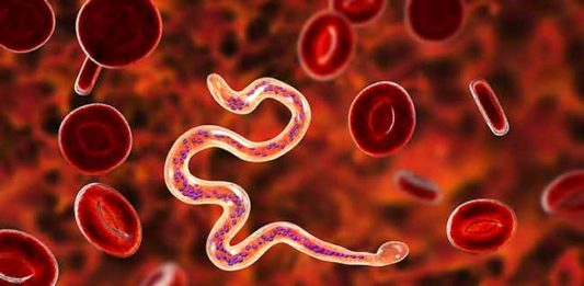 पालघर जिल्ह्यातील ८० बालकांच्या रक्तात सापडले हत्तीरोगाचे सुक्ष्मजीव