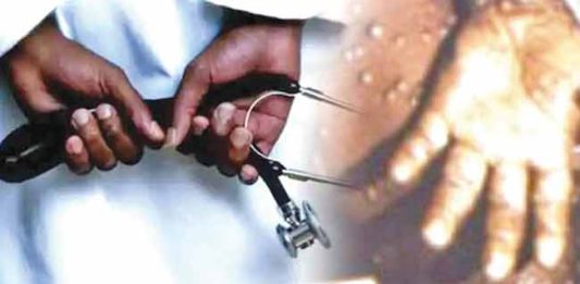 ‘मंकीपॉक्स’च्या पार्श्वभूमीवर महापालिकेची जय्यत तयारी