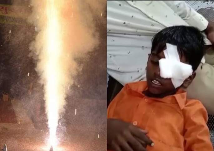 फटाके फोडताना लहान मुलाने डोळा गमावला