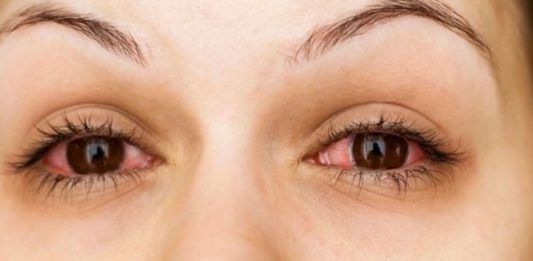 eye infection : राज्यात लाखाहून अधिक लोकांना डोळ्यांच्या जंतुसंसर्गाने पछाडले!