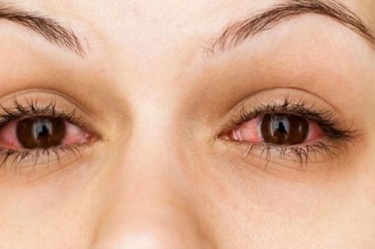 eye infection : राज्यात लाखाहून अधिक लोकांना डोळ्यांच्या जंतुसंसर्गाने पछाडले!