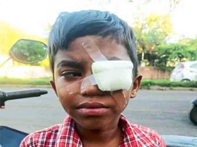 हातात फटाका फुटल्याने डोळ्याला गंभीर दुखापत
