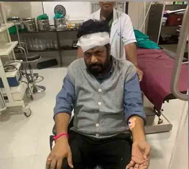 आमदार बच्चू कडू यांना दुचाकीने ठोकले, डोक्याला ४ टाके पडले