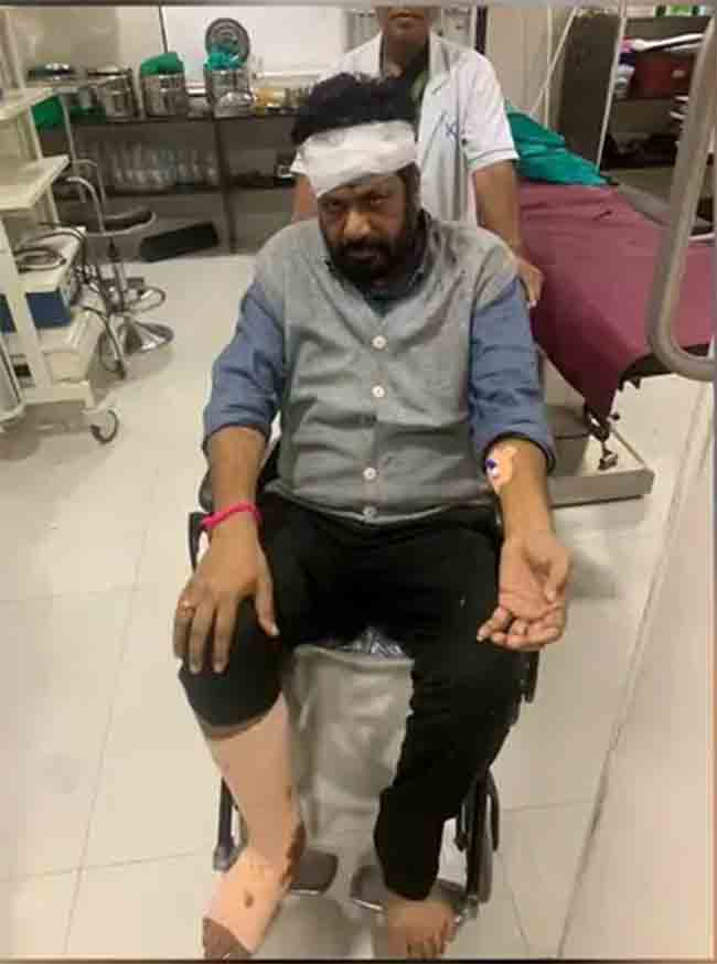 आमदार बच्चू कडू यांना दुचाकीने ठोकले, डोक्याला ४ टाके पडले