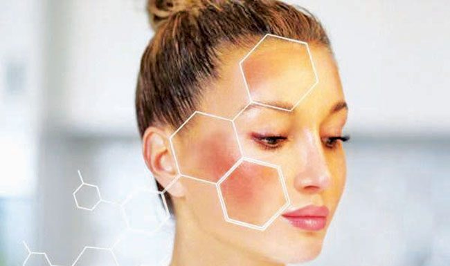 चेहऱ्याचे हायपरपिग्मेंटेशन