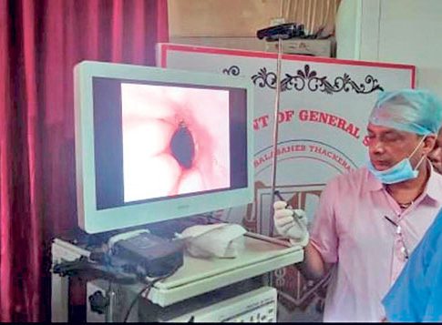 विलेपार्लेतील कूपर रुग्णालयात एन्डोस्कोपी सेवेचा प्रारंभ