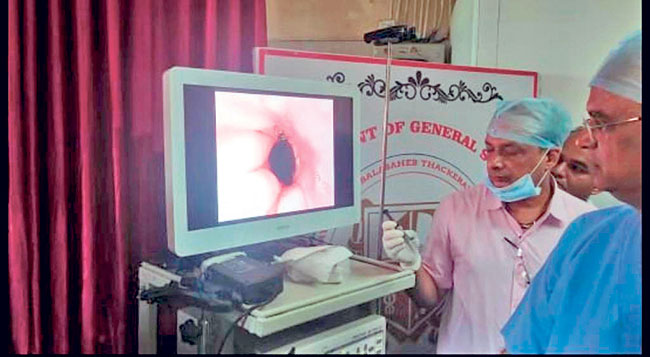 विलेपार्लेतील कूपर रुग्णालयात एन्डोस्कोपी सेवेचा प्रारंभ