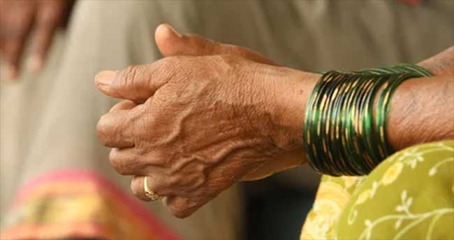 दुर्लक्ष