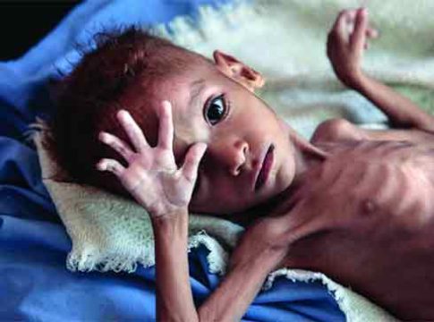 अमरावतीत कुपोषणामुळे ४ महिन्यांत २६९ बालकांचा मृत्यू