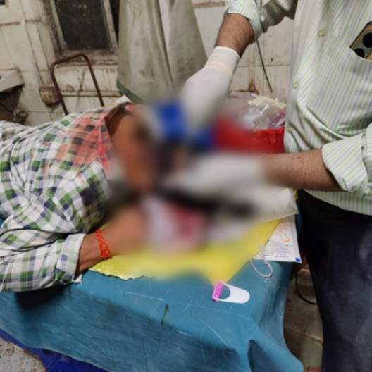 गरबा कार्यक्रमात दांडक्याने हाणामारी; तीन जण जखमी