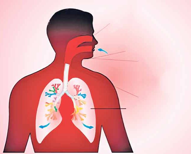 उचकी कशी लागते?