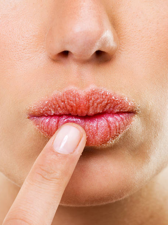 Lip Care : कोरड्या ओठांची समस्या दूर करण्यासाठी ‘हे’ 6 खास उपाय!