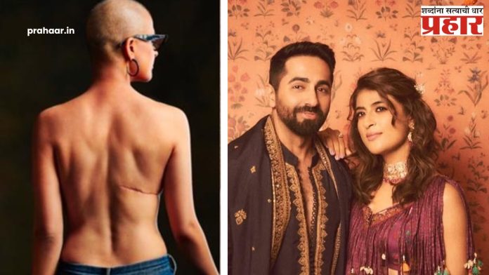 Tahira Kashyap Breast Cancer Relapse : अभिनेता आयुष्मान खुरानाच्या पत्नीला दुसऱ्यांदा कॅन्सरचं निदान
