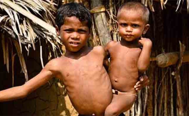 मुंबईत तीव्र कुपोषित बालकांची संख्या चिंताजनक