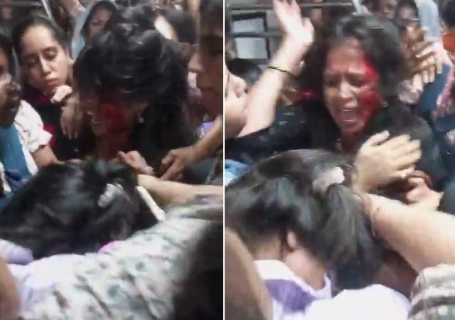 Woman Fight in Local: बापरे! महिलांच्या डब्यात फ्रीस्टाइल हाणामारी; डोकं फुटेपर्यंत मारलं