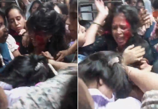 Woman Fight in Local: बापरे! महिलांच्या डब्यात फ्रीस्टाइल हाणामारी; डोकं फुटेपर्यंत मारलं