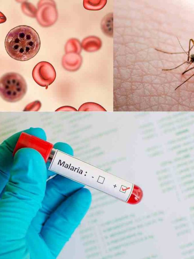मुंबईत मलेरियाच्या रुग्णसंख्येत मोठी वाढ