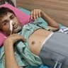 तरुणाचं ऑपरेशन, पोटातून काढल्या या वस्तू; डॉक्टर पण चक्रावले