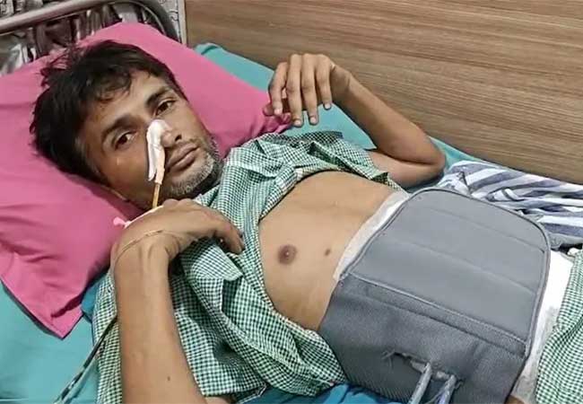 तरुणाचं ऑपरेशन, पोटातून काढल्या या वस्तू; डॉक्टर पण चक्रावले