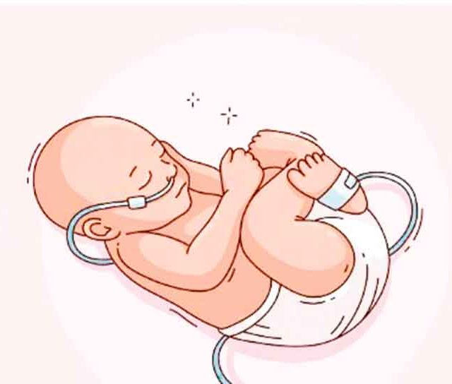 अकाली प्रसूती
