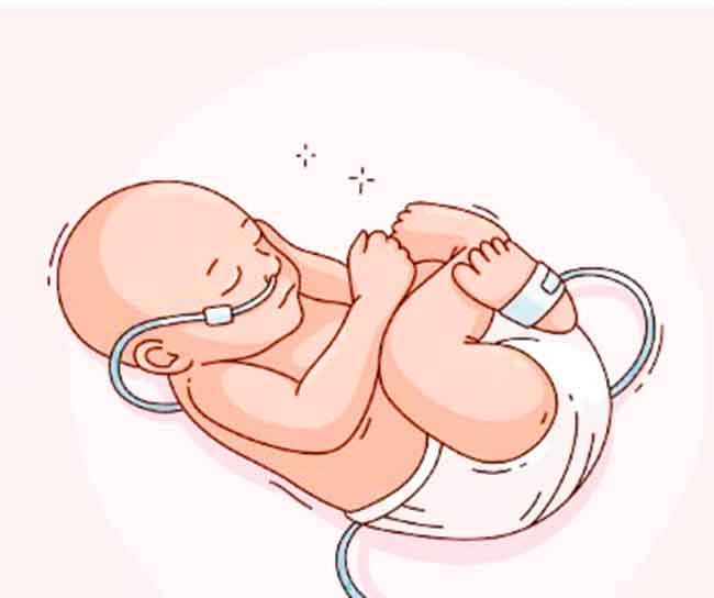 अकाली प्रसूती