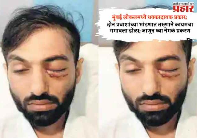 दोन प्रवाशांच्या भांडणात तरुणाने कायमचा गमावला डोळा; जाणून घ्या नेमकं प्रकरण