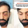 दोन प्रवाशांच्या भांडणात तरुणाने कायमचा गमावला डोळा; जाणून घ्या नेमकं प्रकरण