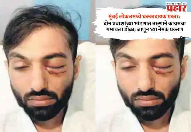 दोन प्रवाशांच्या भांडणात तरुणाने कायमचा गमावला डोळा; जाणून घ्या नेमकं प्रकरण