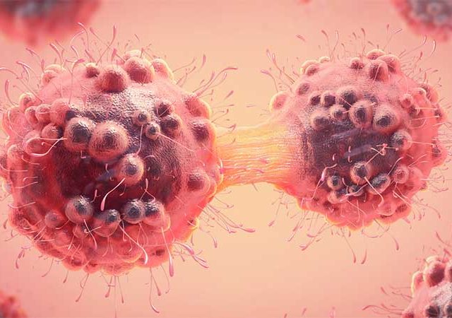 महापालिका स्वच्छता कामगारांची विशेष कर्करोगाची तपासणी