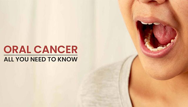 महापालिकेच्या आपला दवाखान्यामध्येही मुख कर्करोगाची तपासणी