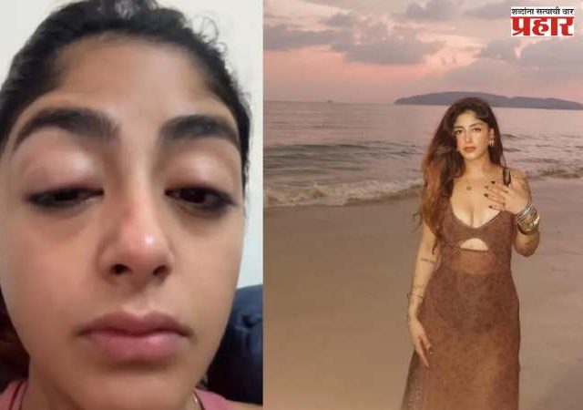 Preet Singh : मुंबईत 'या' अभिनेत्रीला जबर मारहाण; डोळे सुजले, दात पाडले