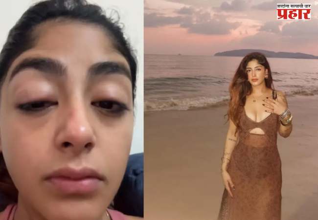 Preet Singh : मुंबईत ‘या’ अभिनेत्रीला जबर मारहाण; डोळे सुजले, दात पाडले