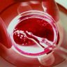 Egg Donation Case : तब्बल ३७ वेळा स्त्री बीज दान, बदलापूर प्रकरणी ५ हजार पानांचे आरोपपत्र ; १५ जणांवर गुन्हा