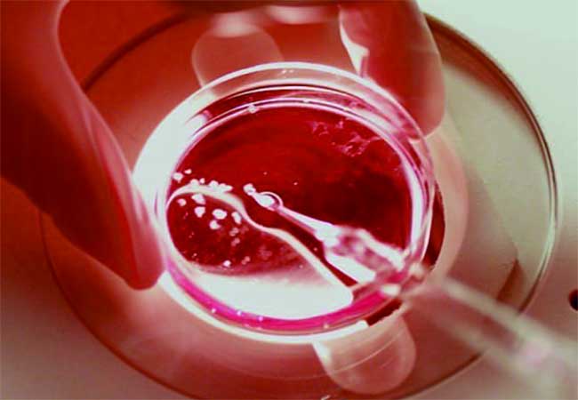 Egg Donation Case : तब्बल ३७ वेळा स्त्री बीज दान, बदलापूर प्रकरणी ५ हजार पानांचे आरोपपत्र ; १५ जणांवर गुन्हा