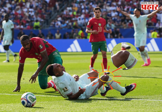 FIFA WORLDCUP 2026 : विश्वचषकात फ्रान्सचा विजय, पण किलियन एम्बाप्पेच्या दुखापतीने चाहत्यांची वाढली चिंता!